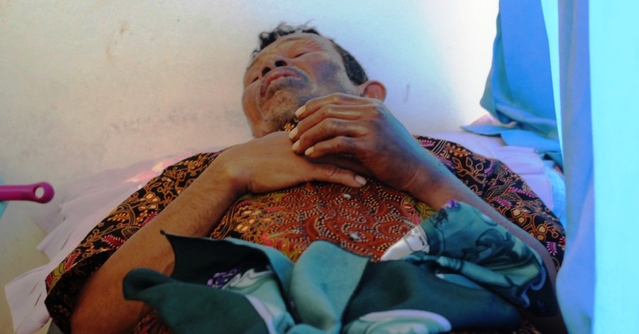 Salah satu korban luka bajar akibat ledakan galon gas. Foto: dara.co.id/Purwanda
