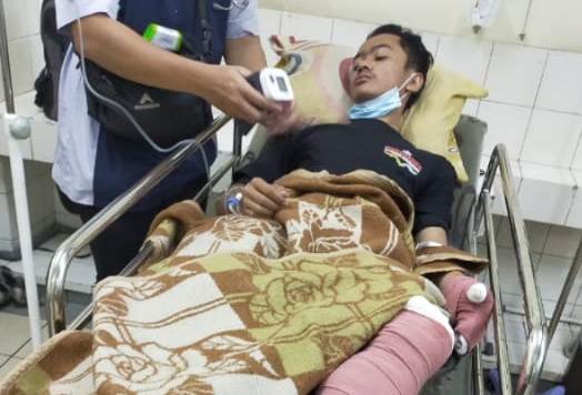 Lutfi menjalani perawatan di RSHS Bandung, setelah mengalami luka bakar akibat kebakaran di salah satu pabrik di KBB, Jawa Barat, Ahad (19/4/2020) malam. (Foto: Istimewa)