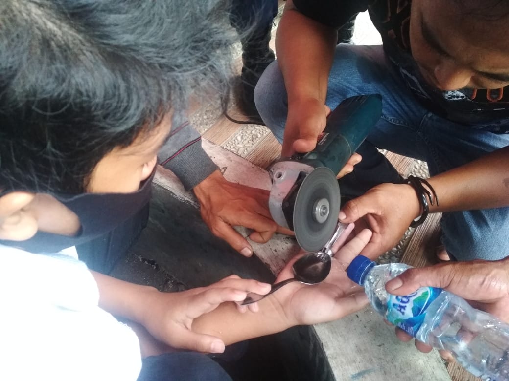 Petugas Disdamkar Garut berupaya melepaskan cincin di jari Zidan (14) di Kantor Disdamkar Garut, (Foto: Andre/dara.co.id)