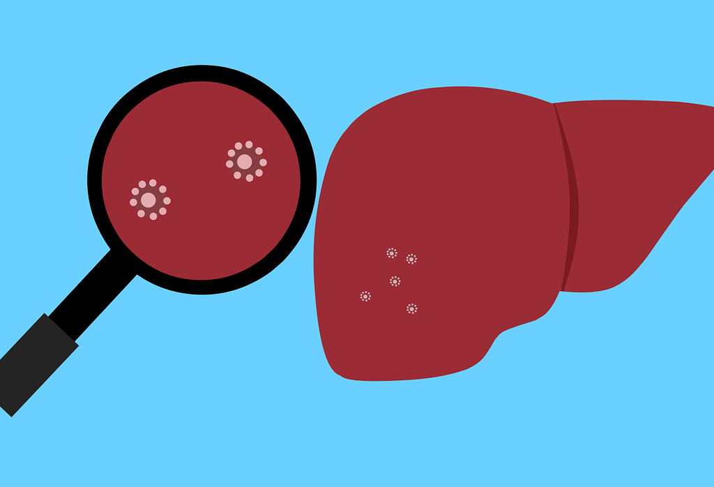 Ilustrasi hepatitis akut misterius. /Pixabay/mohamed_hassan/