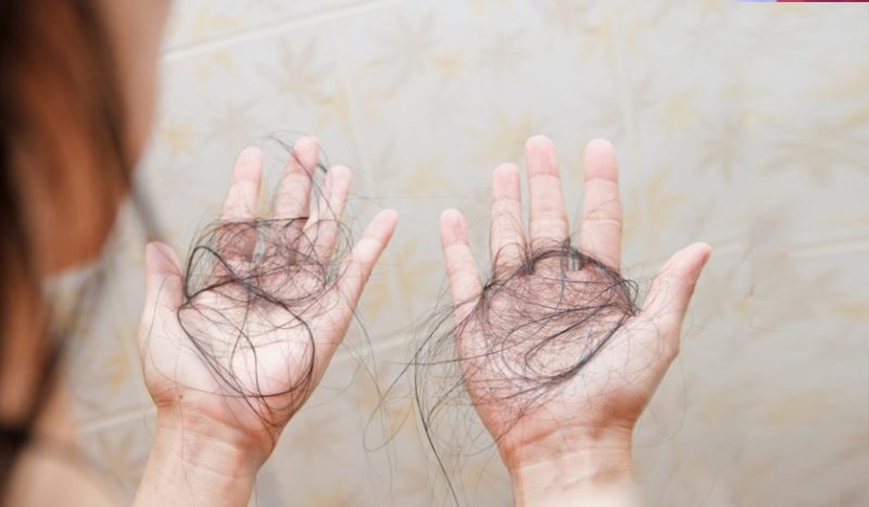 Gejala kolesterol tinggi bisa timbul disejumlah bagian tubuh, salah satunya rambut rontok. (Foto: PMJ News/Beauty Journal)